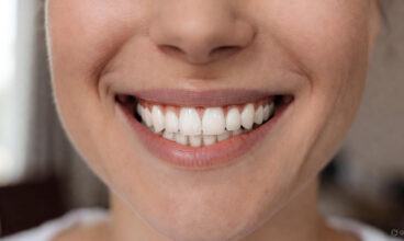 Teeth Whitening: What Actually Works (and What Doesn’t)